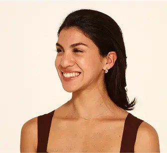 After Botox treatment for crow's feet