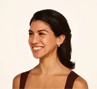 Before Botox treatment for crow's feet