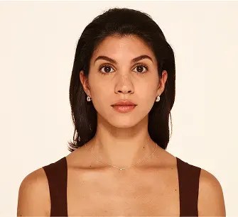 After Botox treatment for forehead lines