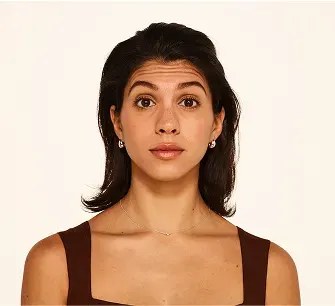 Before Botox treatment for forehead lines