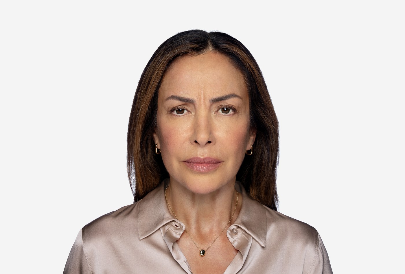 Before Daxxify treatment, at maximum frown