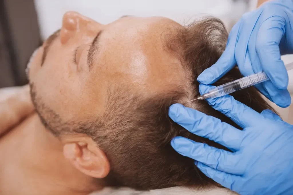 a person getting Hair Restoration in Hamilton, NJ