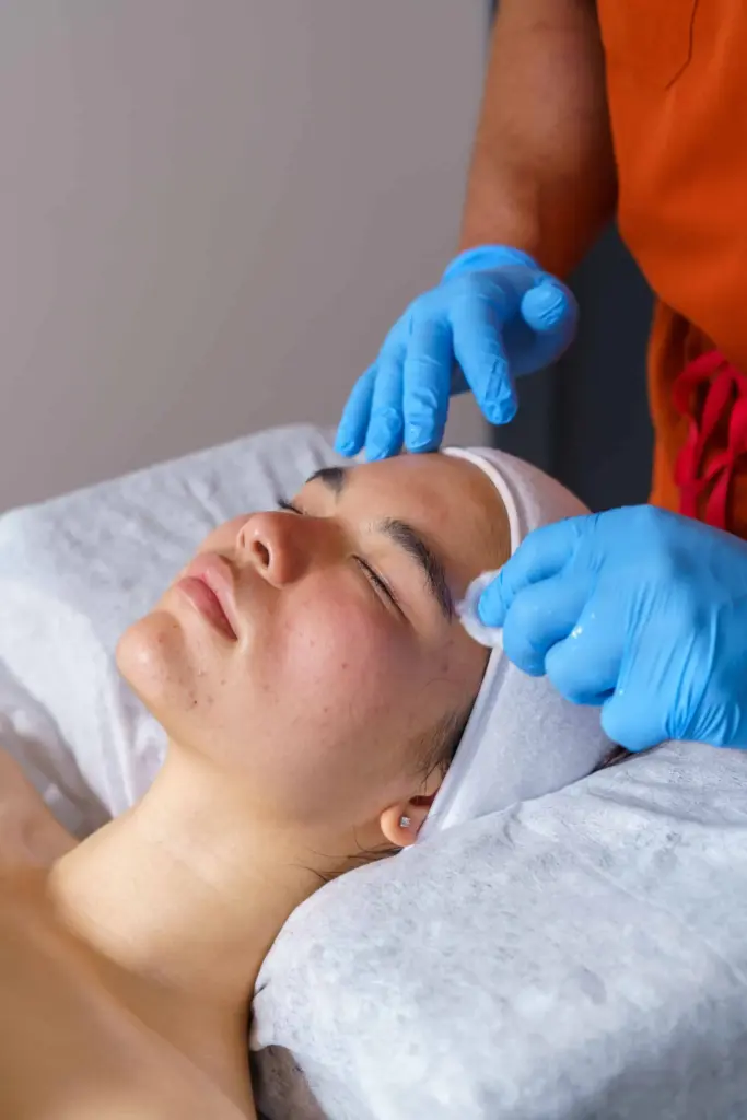 Face Reality Acne Treatment-At Estetica Medical Aesthetics